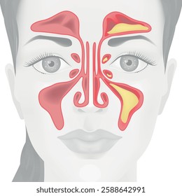 Medical poster, background, with a girl's face and a sinus. Vector