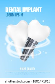 Medical poster with realistic 3d illustration dental implant and human tooth. Vector banner with dental implant advertisement.