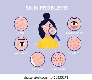 Medical Poster Showing Problems Of Different Types Of Skin Such As Dryness, Pimples And Wrinkles Flat Cartoon Vector Illustration. Beauty And Facial Care Concept.