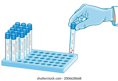 Medical professionals in rubber gloves, doctor, nurse and COVID-19 test tube with smears, saliva samples snd red virus cell or Coronavirus on tray, COVID-19 virus pandemic Concept. illustration.