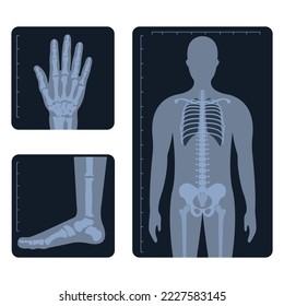 Medical radiology. Different x-ray or radiographic images of human body bones and parts