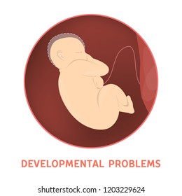 Medical reasons for cesarean delivery or c-section. Developmental problem. Fetus with health issues. Isolated vector flat illustration