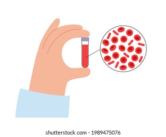 Medical research of erythrocytes. Red blood cells graphic concept. Human blood structure and sample collection in laboratory. Microbiology test vector illustration. Blood disease exam and treatment