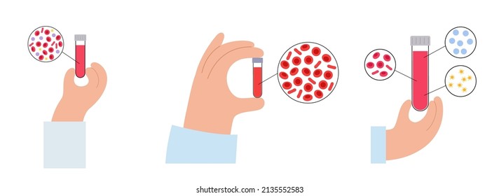 Medical Research Of Erythrocytes, Thrombocytes And Leukocytes. RBC, WBC And PRP Therapy Graphic Concept. Platelet Rich Plasma Treatment. Human Blood Structure. Microbiology Test Vector Illustration