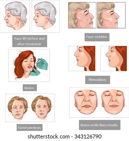 401 Facial paralysis Images, Stock Photos & Vectors | Shutterstock