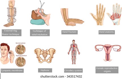 medical set(external ring,technique of tubal intubation,hand fracture,hand anatomy,tympanic membrane,h?pbone,circulary system,female reproductive organs