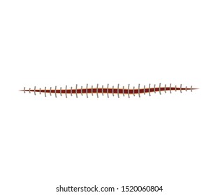 Medical Suture Or Stitch For Injury Isolated On White Background