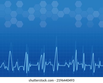 tecnología médica con antecedentes de latidos cardíacos