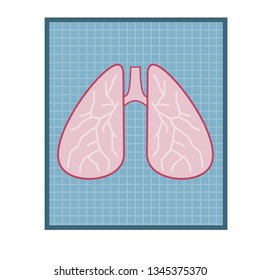 Medical tests and diagnosis. Problems breathing and lungs. Internal human organ. X-ray and photo image on a blue sheet. Element of hospital and medical care. Cartoon flat illustration