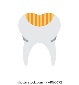 Medical - Tooth Decay 
