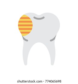 Medical - Tooth Decay 