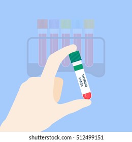 Medical Tubing For Thyroid Panel Test. Hand Holding Blood Sample. Laboratory Centrifuge Medical Equipment On Blue Background. Vector Illustration.
