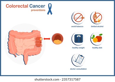 Medical vector illustration concept.Human colorectal cancer.Colorectal cancer preventions.avoid tobacco,limited alcohol,healthy weight,healthy diet and doctor consultation.isolated on white background