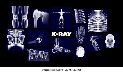 Medical X-ray 3D images of the human body - knee, chest, hip joint, teeth, MRI of the brain, arm, leg, hand, skull, spine. Medical X-ray images of joints, bones. Orthopedic scan. Bone anatomy. Vector