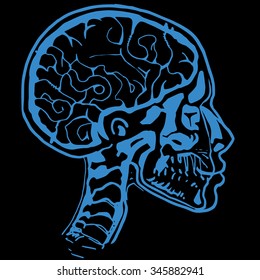 Medical X-ray scan of a male human head with skull and brain.