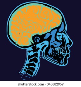 Medical X-ray scan of a male human head with skull and brain.