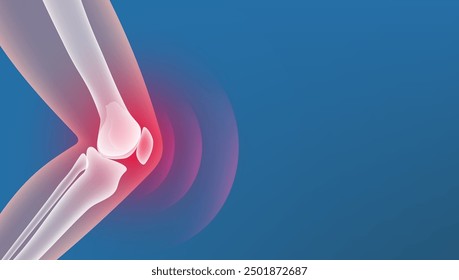 Medical X-Ray Style Leg Bone And Knee Joint Inflammation. EPS10 Vector