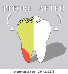 Médicamente detallado antes y después de la higiene dental ilustración que muestra la transformación de la salud dental. Ideal para clínicas dentales, materiales educativos y promociones de salud bucal. claro e informativo