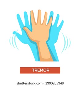 Medicine hand tremor neurological disorder isolated human body part vector muscle contraction twitching movements nerves system disease or illness medical problem treatment incontrolled limbs shaking