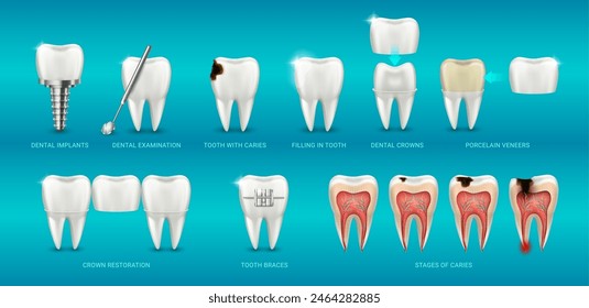 Medicine and healthcare in clinic, teeth care and treatment. Vector dental examination, braces and implants, crown restoration and porcelain veneers, stages of caries and prosthesis filling in tooth