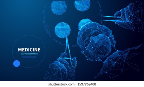 Medicine low poly wireframe vector banner template. Polygonal surgeon in operating room. Surgery 3D mesh art. Emergency help, healthcare. Medic with surgical tool illustration with connected dots