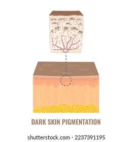 Melanin content and distribution in dark skin phototype. Pigmentation mechanism infographic diagram. Epidermis cross-section in closeup. Vector illustration.