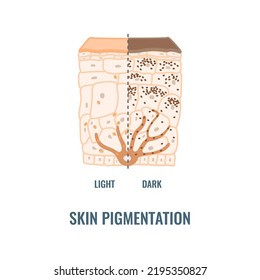 Contenido y distribución de melanina en diferentes fototipos de piel. Mecanismo de pigmentación en piel oscura y clara. diagrama médico de sección de epizootias. Ilustración vectorial.