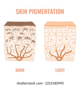 Melanin Content Distribution Different Skin Phototypes Stock Vector ...