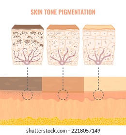 Melanin content and distribution in different skin phototypes. Pigmentation mechanism in dark, olive and light skin. Epidermis cross-section infographic medical diagram. Vector illustration.