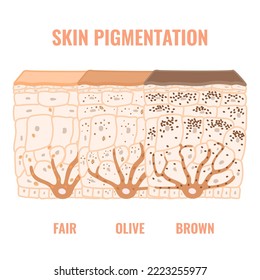 Melanin content and distribution in different skin tone phototypes. Pigmentation mechanism in dark, olive and light skin. Epidermis cross-section infographic medical diagram. Vector illustration.