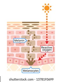 Melanin Facial Dark Spots Skin Layer Stock Vector (Royalty Free ...