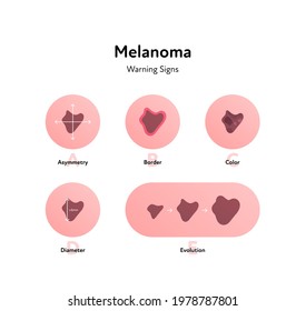 Melanoma cancer anatomical infographic poster. Vector flat medical illustration. Warning signs of tumor disease. Asymmetry, border, color, diameter. Design for healthcare, oncology, dermatology.