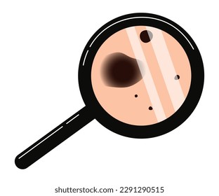 Melanoma diagnosis, skin cancer prevention icon. Checking moles, birthmarks under magnifier. Vector illustration isolated on white background