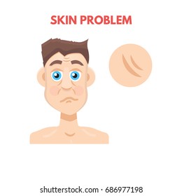 Men skin problem. Facial care. Vector illustration.