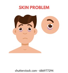 Men skin problem. Facial care. Vector illustration.