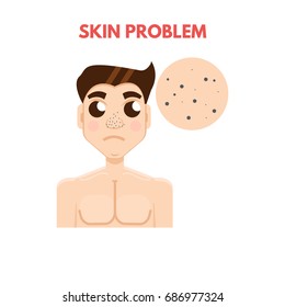 Men skin problem. Facial care. Vector illustration.