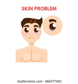 Men skin problem. Facial care. Vector illustration.
