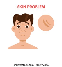 Men skin problem. Facial care. Vector illustration.