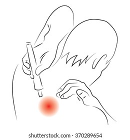 Men squeezes cream on the back or the neck of the tube
