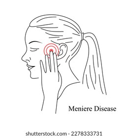 Meniere Disease concept. The girl is holding her ear, suffering from pain. Non-purulent disease of the inner ear. Rare disease. Health care linear Vector illustration 