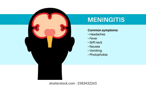Meningitis inflammation of the protective layers surrounding the brain and spinal cord. Meninges disease medical poster. Main symptoms headache, stiff neck, vomiting and fever flat vector illustration