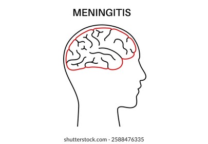 Meningitis inflammation of the protective layers surrounding the brain and spinal cord. Meninges disease logo or icon. Bacteria, viruses, fungi, parasites in the human head flat vector illustration