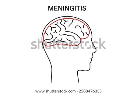 Meningitis inflammation of the protective layers surrounding the brain and spinal cord. Meninges disease logo or icon. Bacteria, viruses, fungi, parasites in the human head flat vector illustration