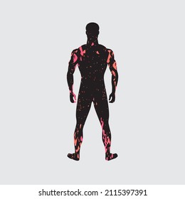 Meningitis rash on darker skin tones. Ethnic minorities skin diseases. Spots all over body.  Patient with meningitis symptoms. Disease manifestation signs. Rash, dermatitis, allergy, dermatology.