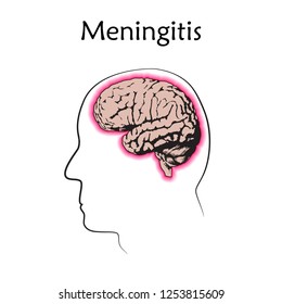 World Meningitis Day Images, Stock Photos & Vectors | Shutterstock