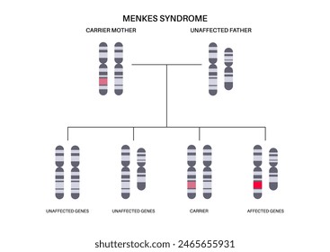 Menkes syndrome, genetic slow development disease pattern. Joint bones and internal organs problem. Child inherits one copy of a mutated gene from each parent. Affected, carriers or healthy chromosome