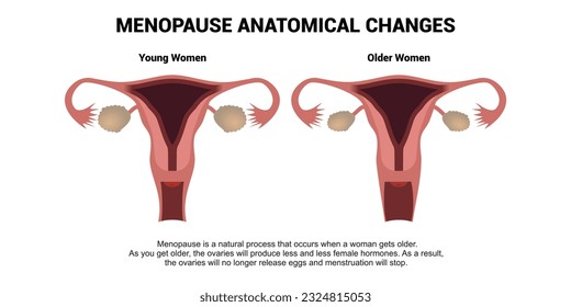 Cambios anatómicos de la menopausia. Comparación del sistema reproductivo femenino de mujeres jóvenes y ancianas con explicaciones. Ilustración vectorial de anatomía realista