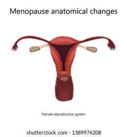 Menopause anatomical changes. Female reproductive system of older woman. Realistic anatomy vector illustration.