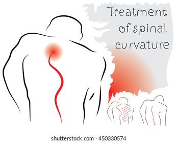 Men's back, the spine line. Vector drawing on the theme of posture, back pain, spinal curvature.
