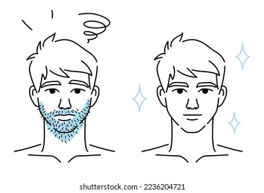 Men's beard hair removal before and after, Beauty body care concept. Vector design illustration.